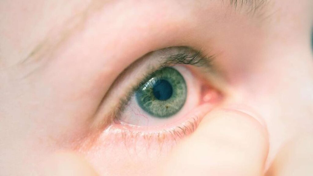 blitze im auge schlaganfall