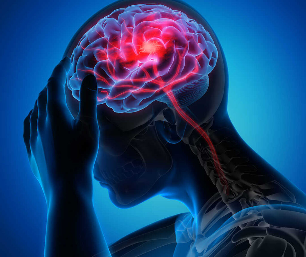 schlaganfall definition