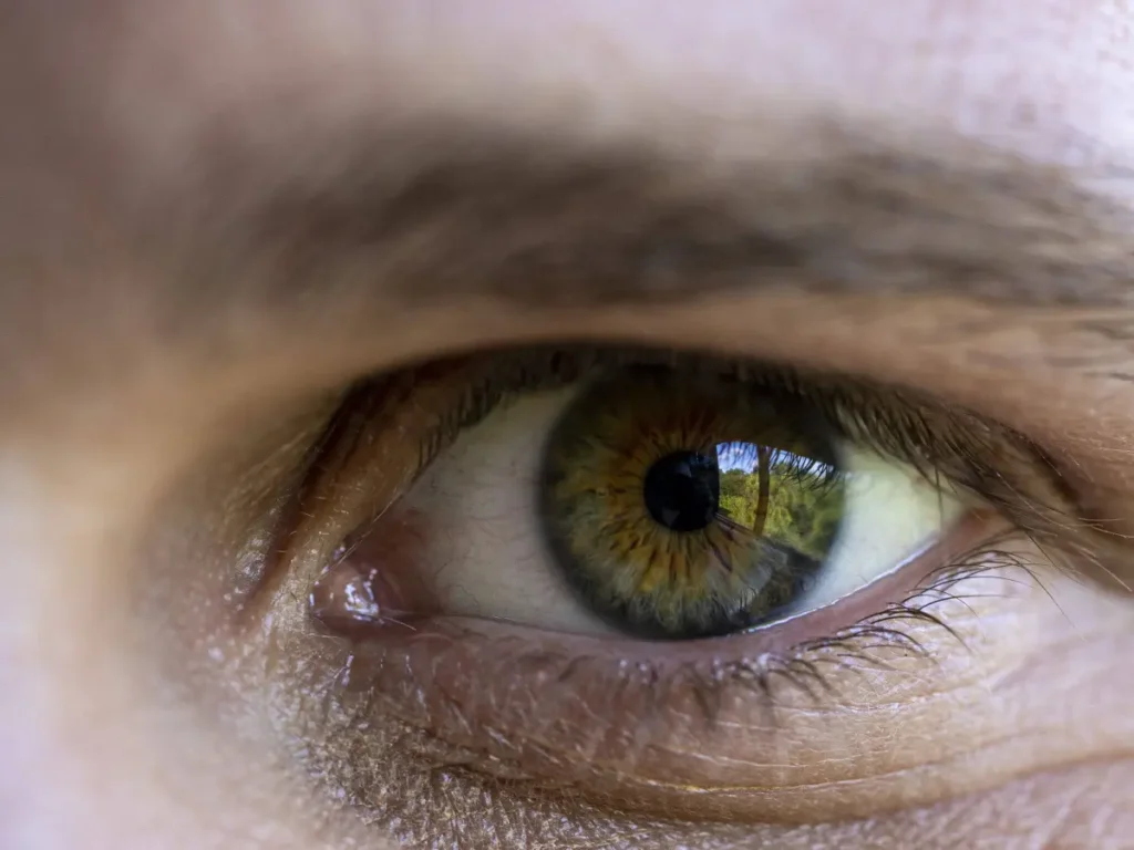 schlaganfall im auge